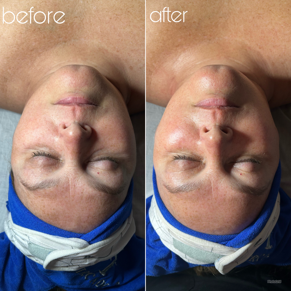 The Time Rewind at Golden Moon Esthetics, LLC in Frisco, TX