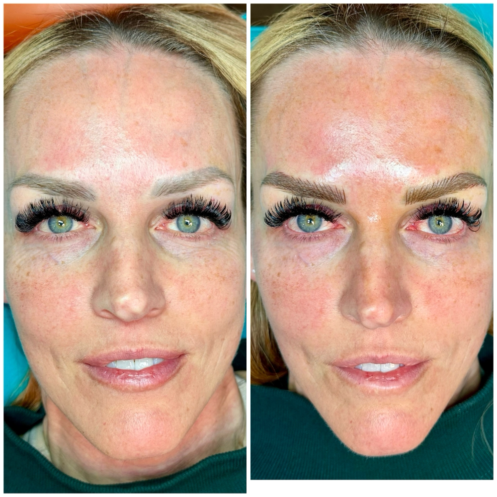4-12 Month Touch Up