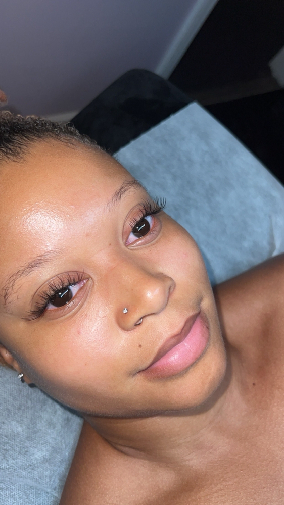 Classic Fill ( 2 Week) at Inalas_esthetique in Uniondale, NY
