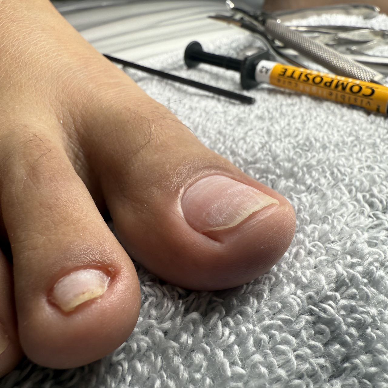 Basic Perfect Nail Shape Follow Up