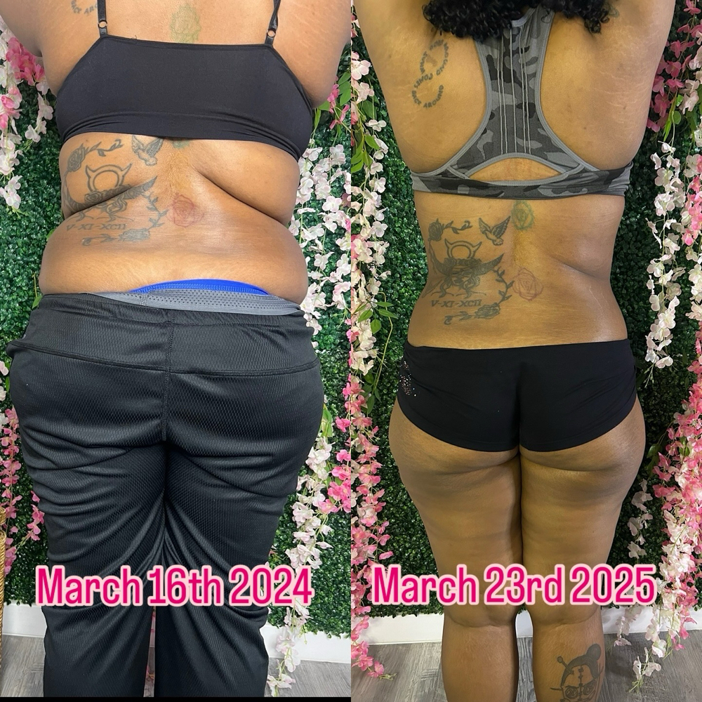 Unbig My Back at HVS BODY in Shaker Hts, OH