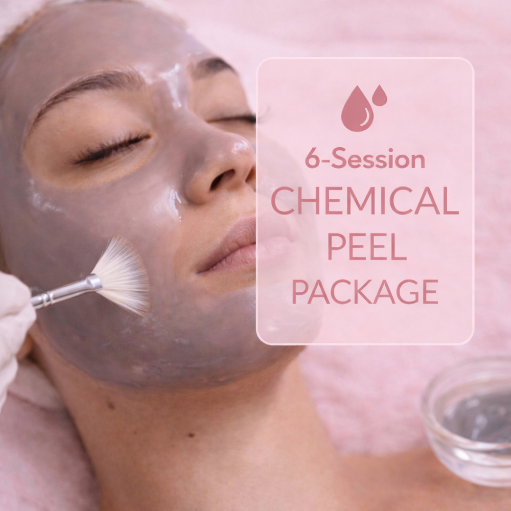 6 Session Chemical Peel at Karma Beauty Spa in Plymouth, MI