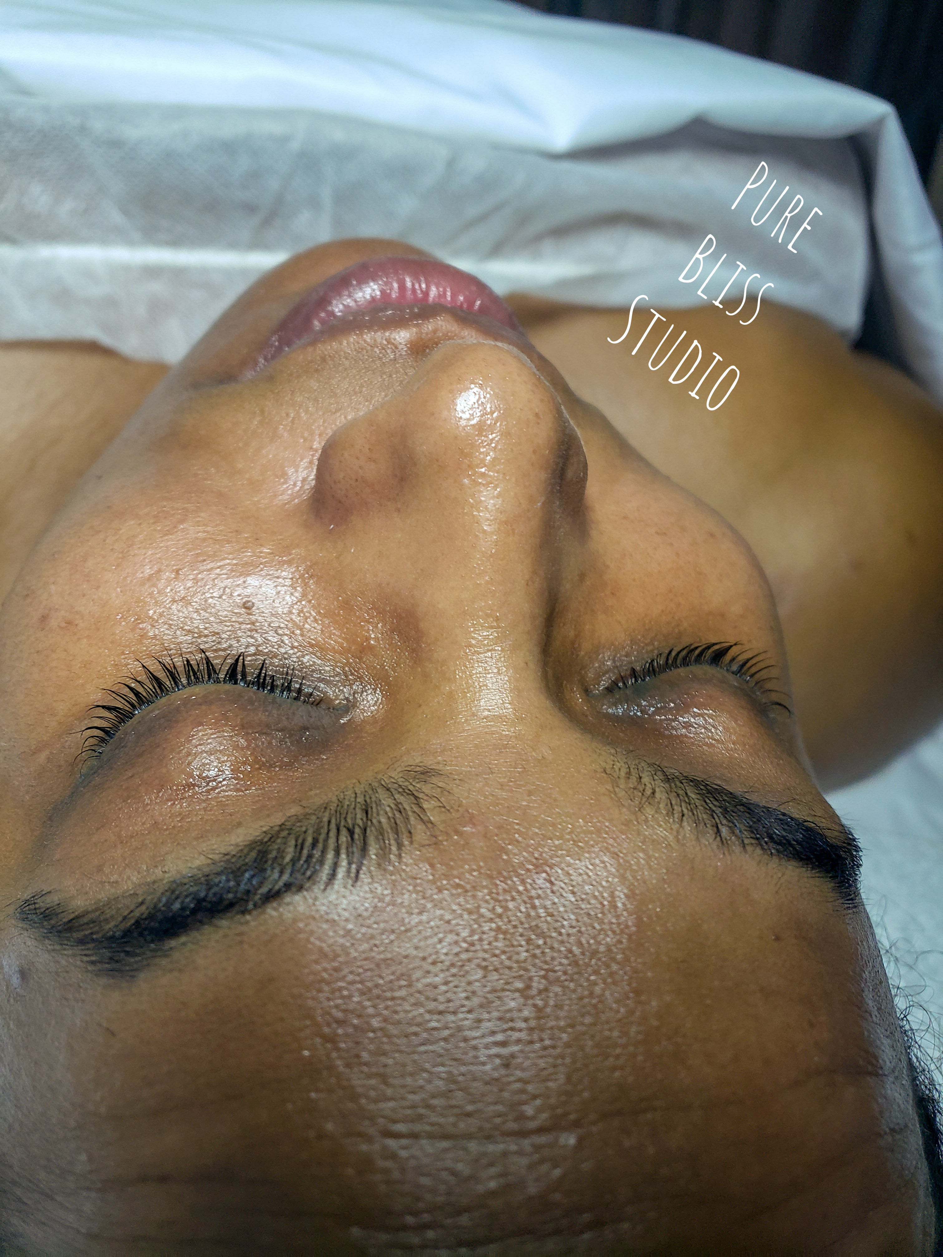 Dermaplane Facial