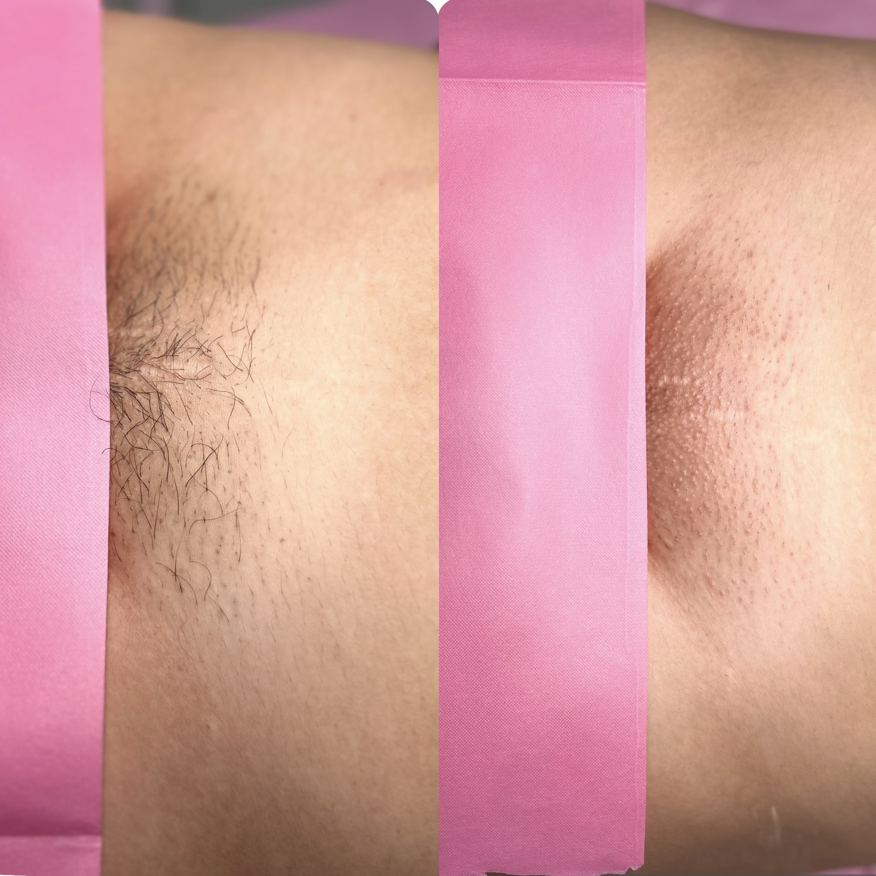 Brazilian Wax + Hydrating Mask
