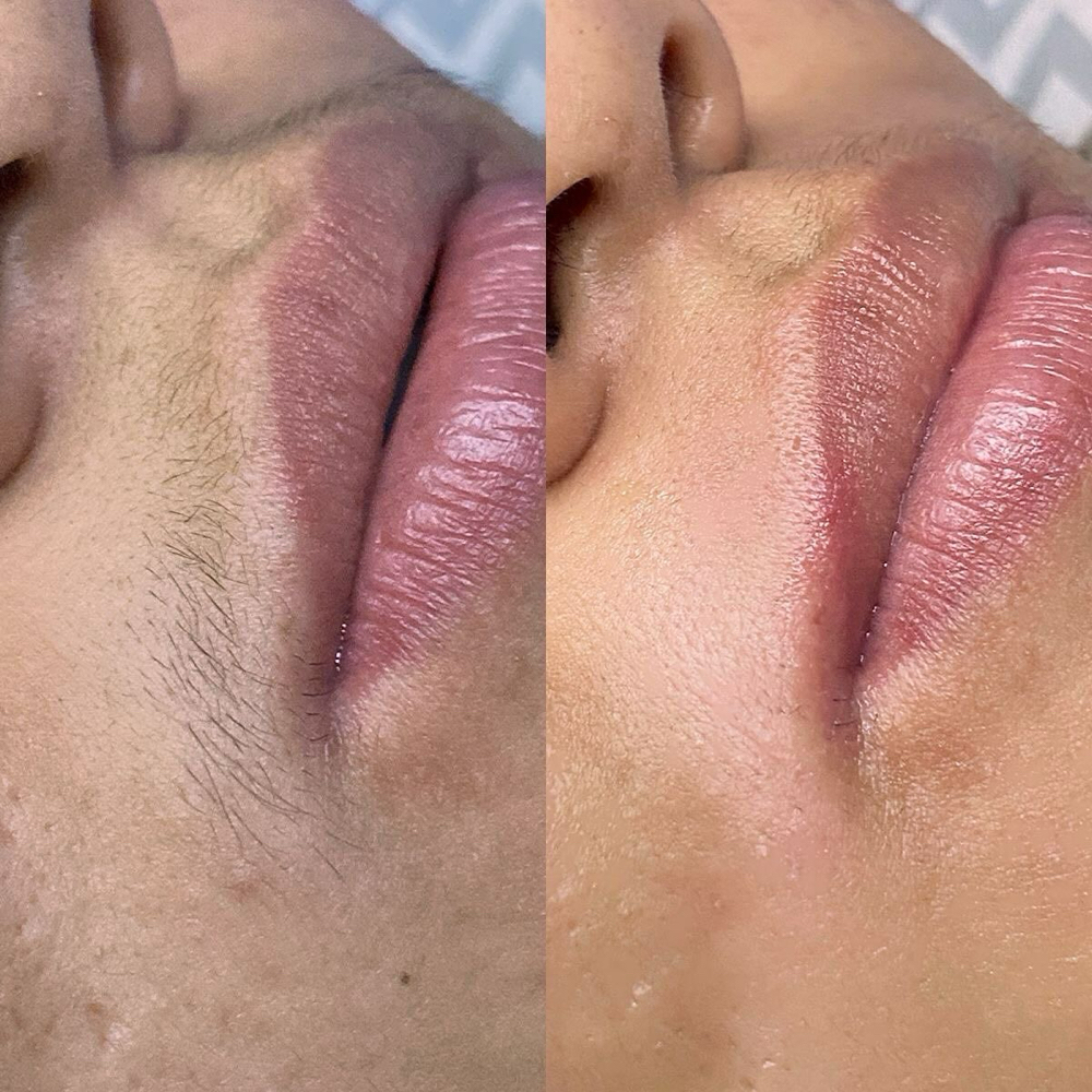 Upper Lip/Lower Lip at 9TwentyNine Waxing Co. in Arlington, TX