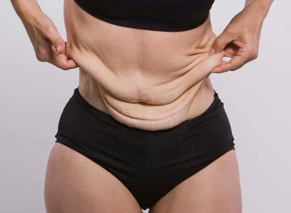 Ultherapy for Stomach (4th Fl)