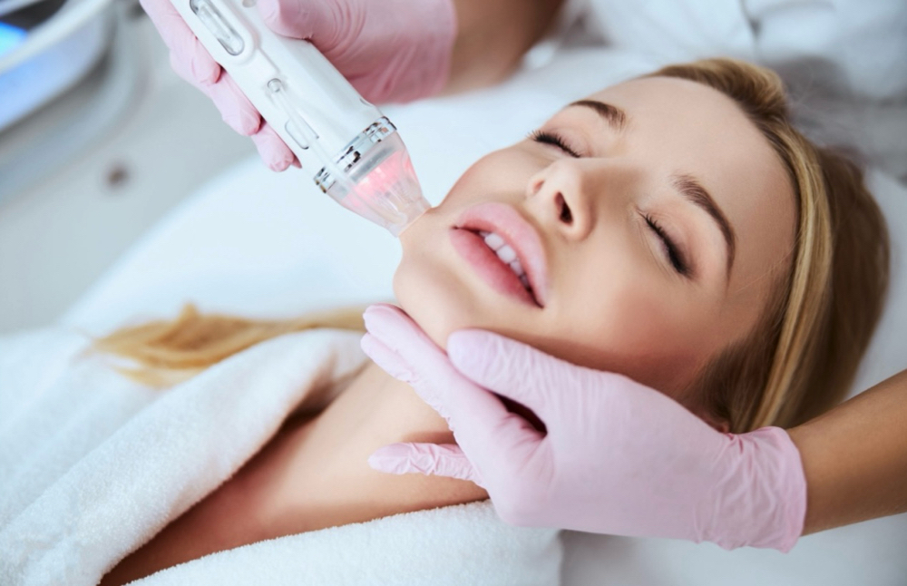 RF Microneedling