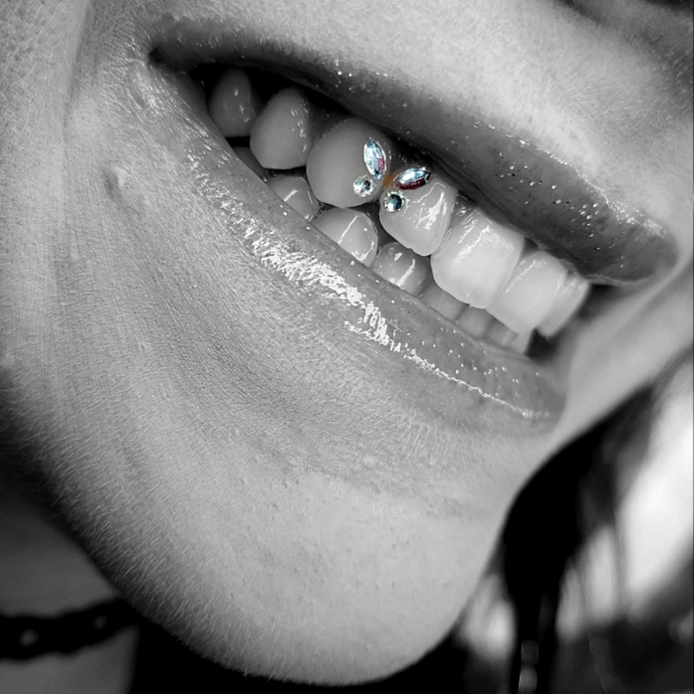 Tooth Gem Design: Butterfly at The Neon Door in Tucson, AZ