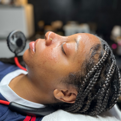 CLEAR ME UP ACNE CONSULT+TREATMENT