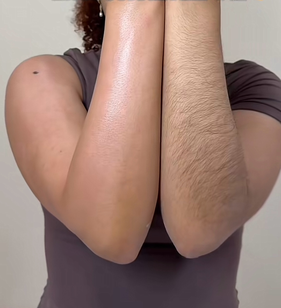 Full Arms Wax