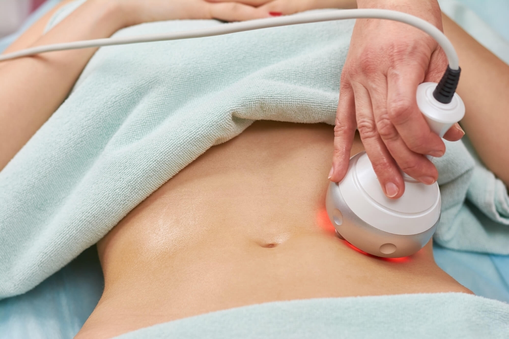 Radio Frequency + Microneedling RF