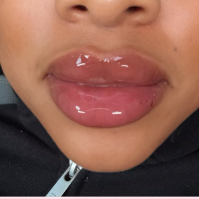 Pillow Pout 💋 | 2 mL at CurvSculpt in Denver, CO