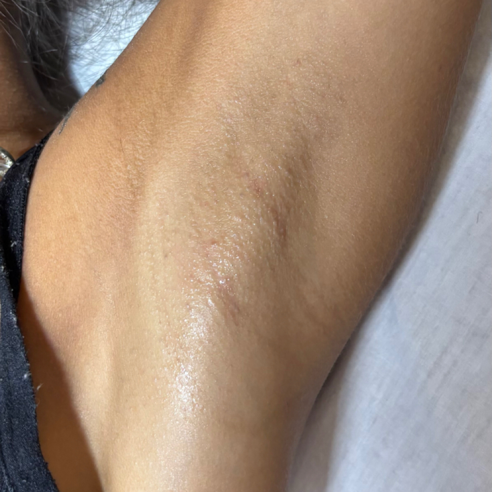 Underarm Sugar Wax at Her Beauty in San Jose, CA