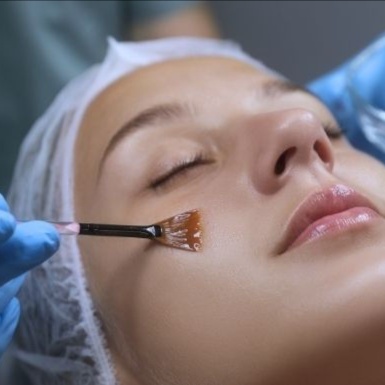 Salicylic Peel at Trinity Beauty Bar in Montclair, NJ