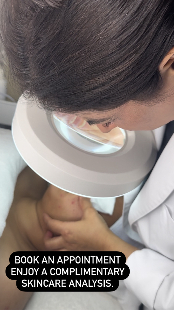 Acne Consultation + Treatment