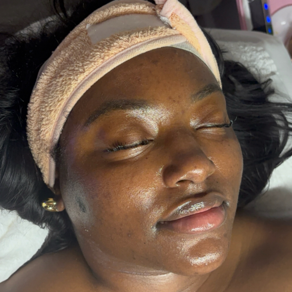 Wellness Wednesday at Zelle Aesthetics in Bedford, TX