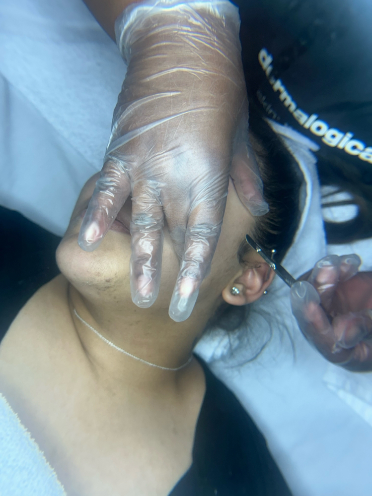 Dermaplaning Facial