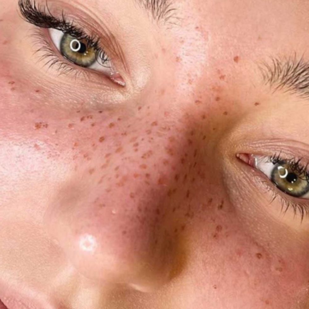 Faux Freckles Enhancement