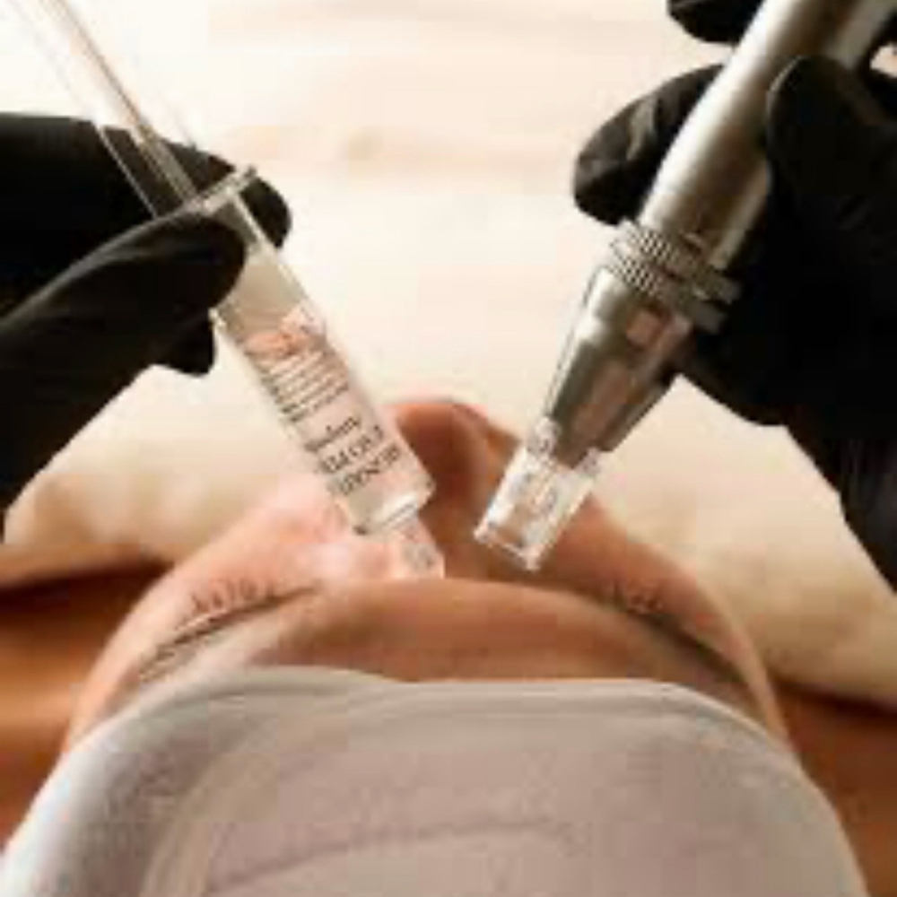 Nano Fusion Glow at Radiance Aesthetics by Aracely in Bakersfield, CA