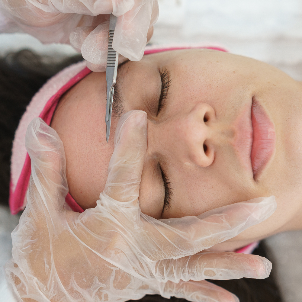 6 Pre-paid Dermaplane Express