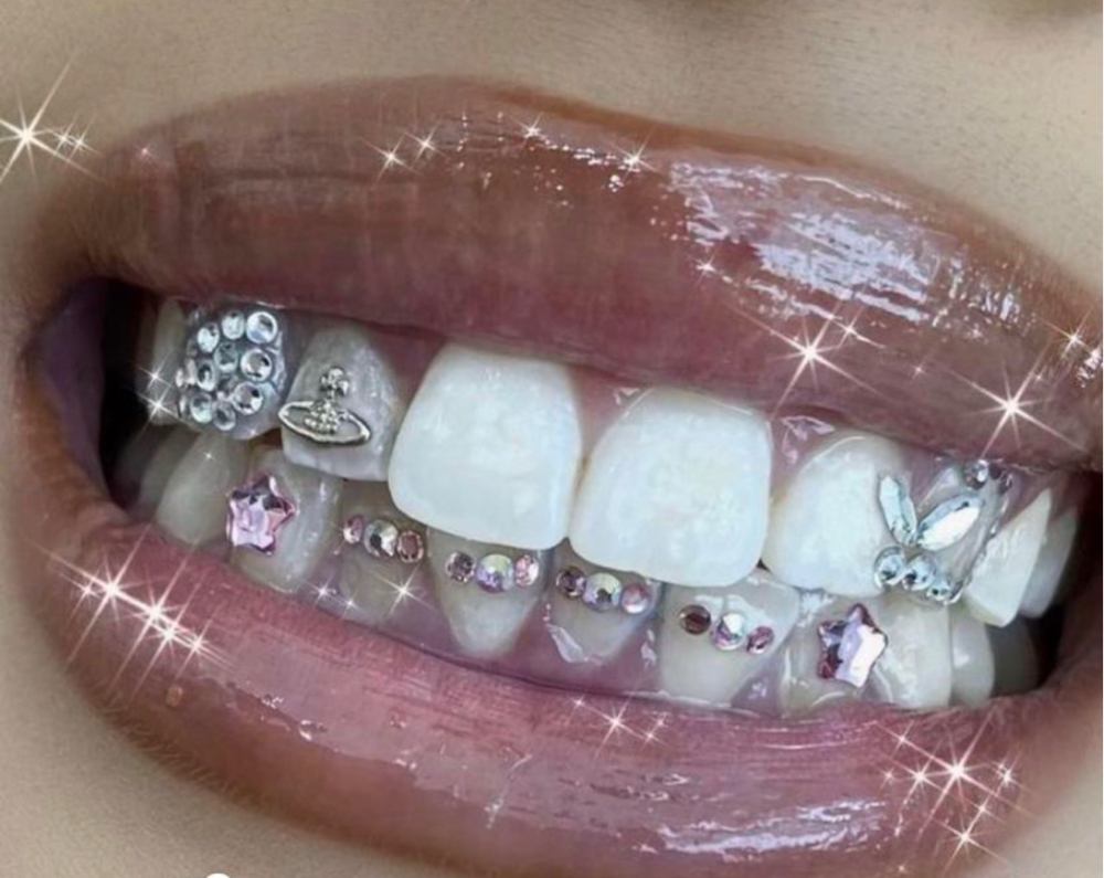 Tooth Gems✨