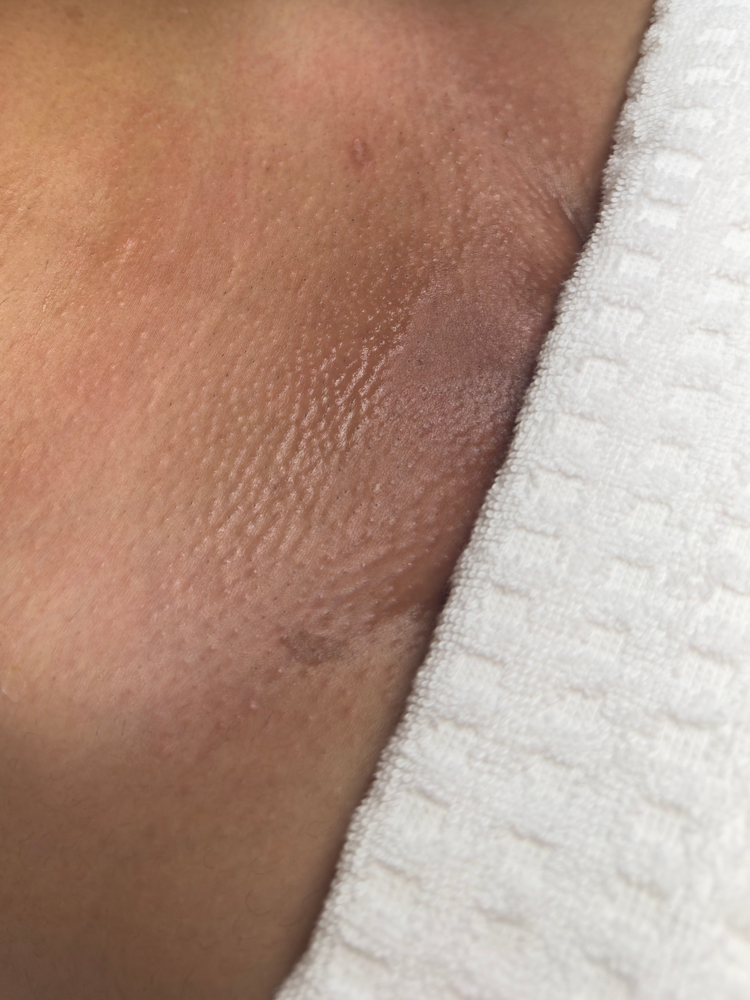 Extended Brazillian at Dose Of Beauty in New Britain, CT