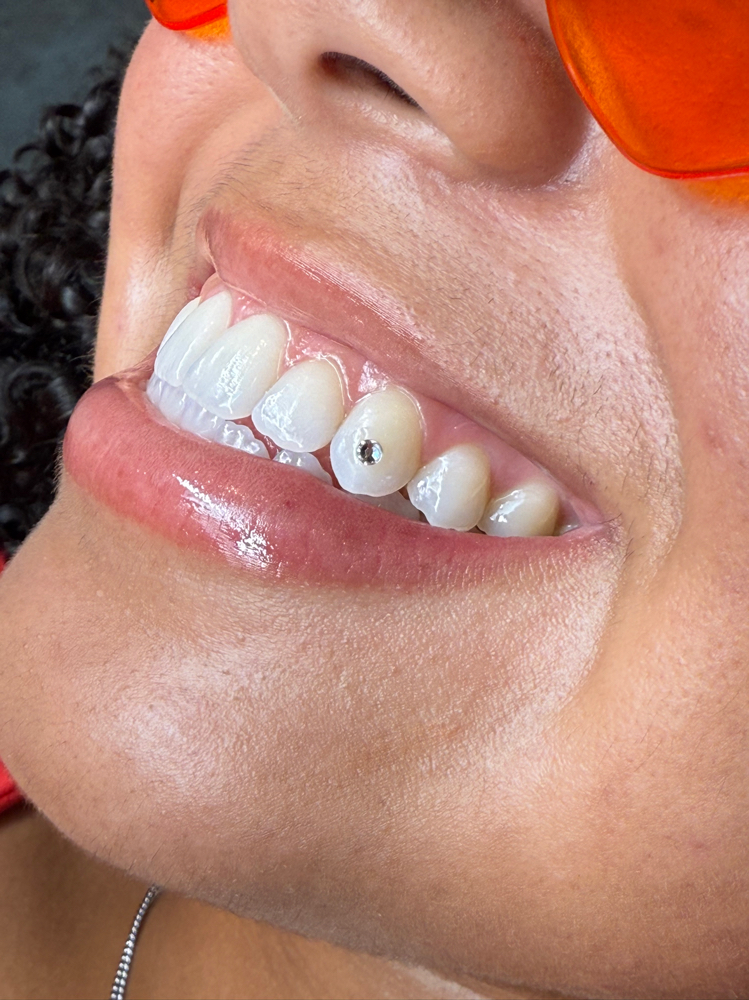 Single Tooth Gem at Beauty Lab Los Angeles in Los Angeles, CA