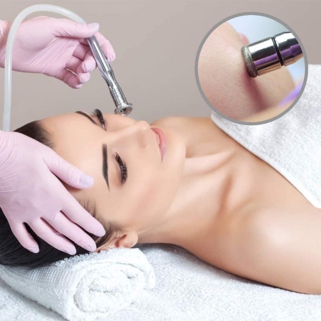 Microdermabrasion + Enzyme Peel