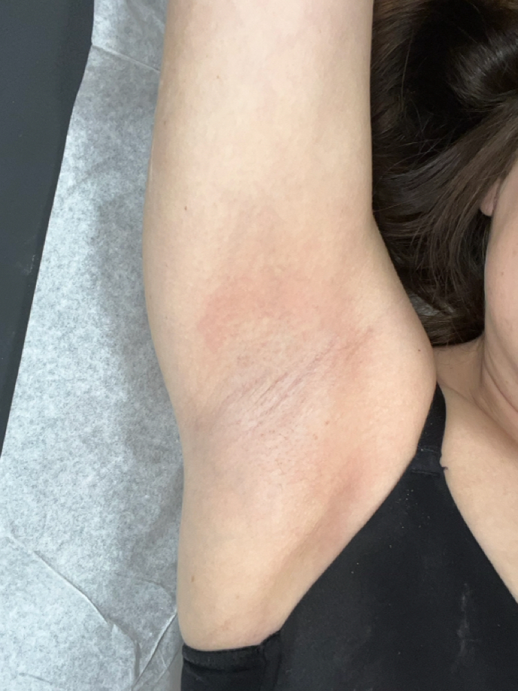 Under Arm Wax at Kimmchiliftz in New Ellenton, SC