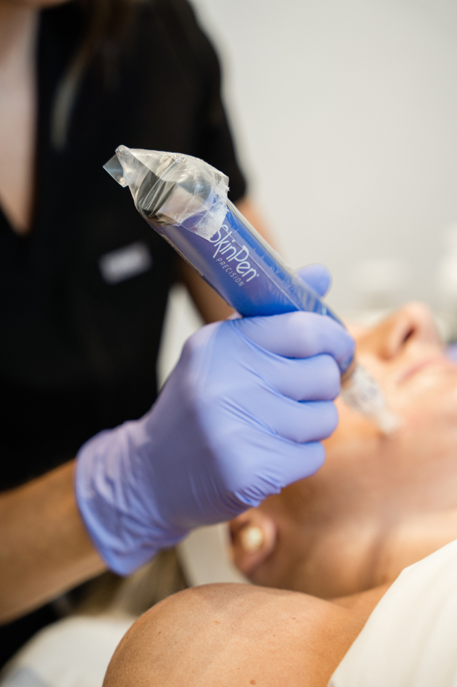 Microneedling (Face & Neck)