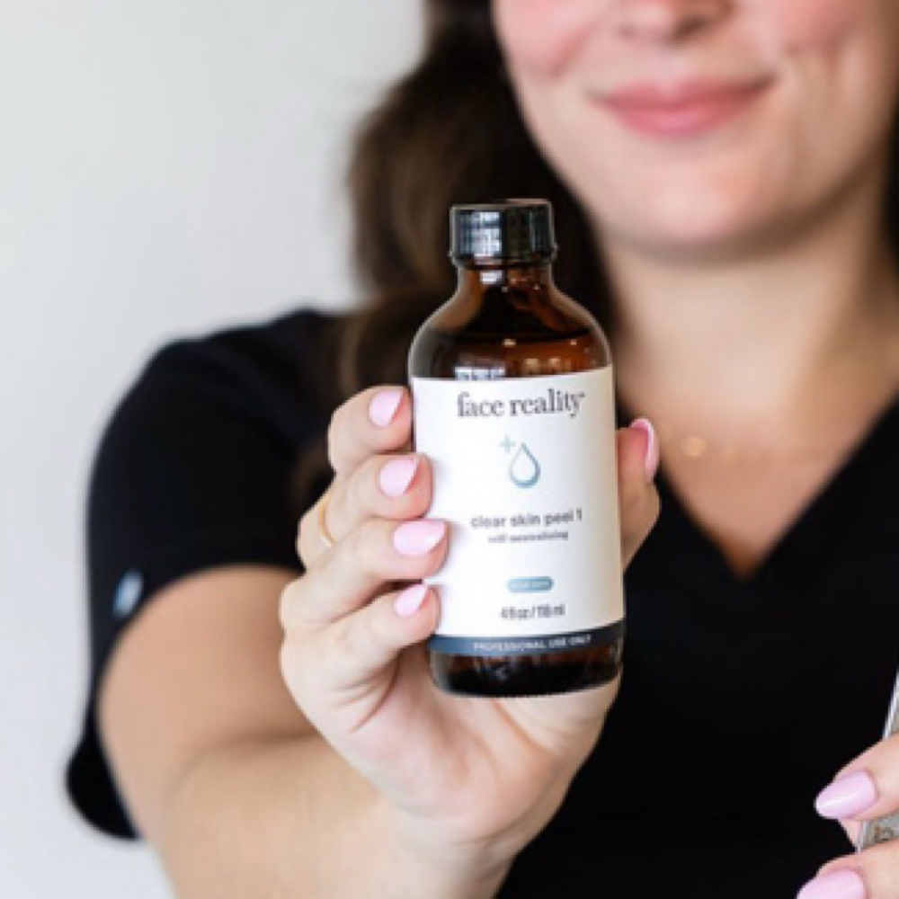 Customized Chemical Peel at Glowing By Mila in Chesterfield, MO