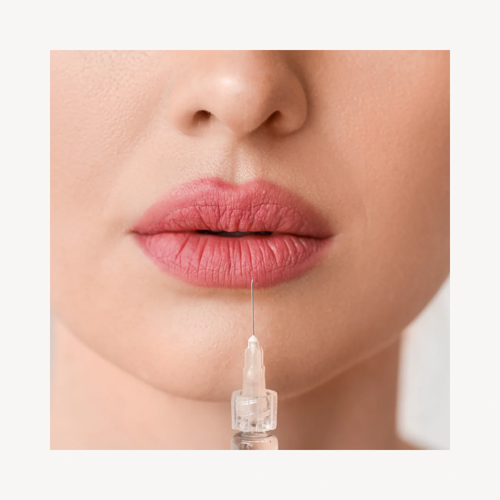 Full Lips filler