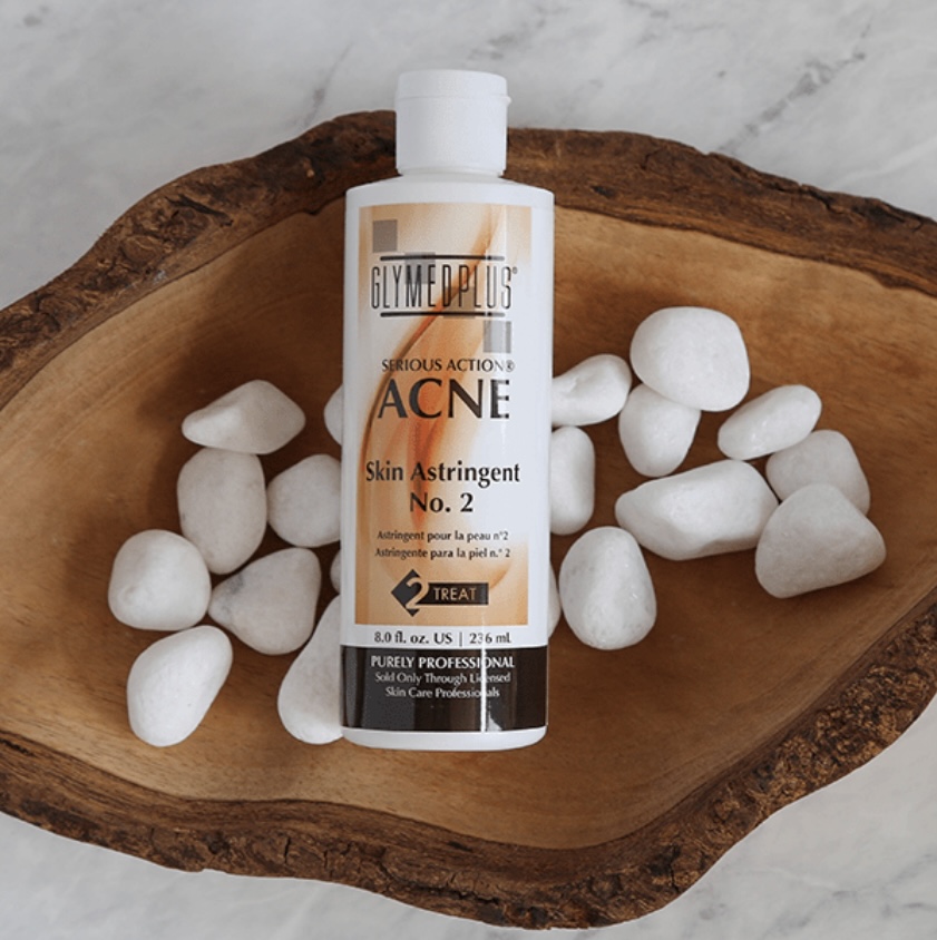 Acne Facial