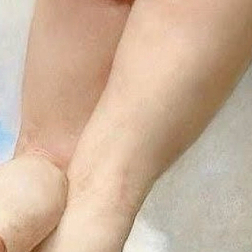 Legs (upper) at Bare Luminous Skin in El Cajon, CA