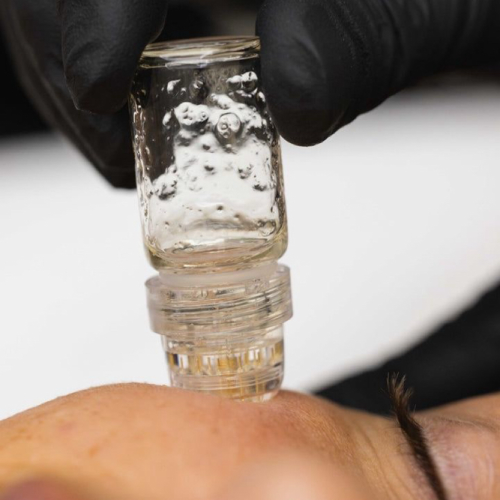 Skin Renewal Micro-Infusion at Glow by Allison in Grapevine, TX