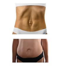 Diastasis Recti Rehab at Pivot Body and Soul in Enid, OK