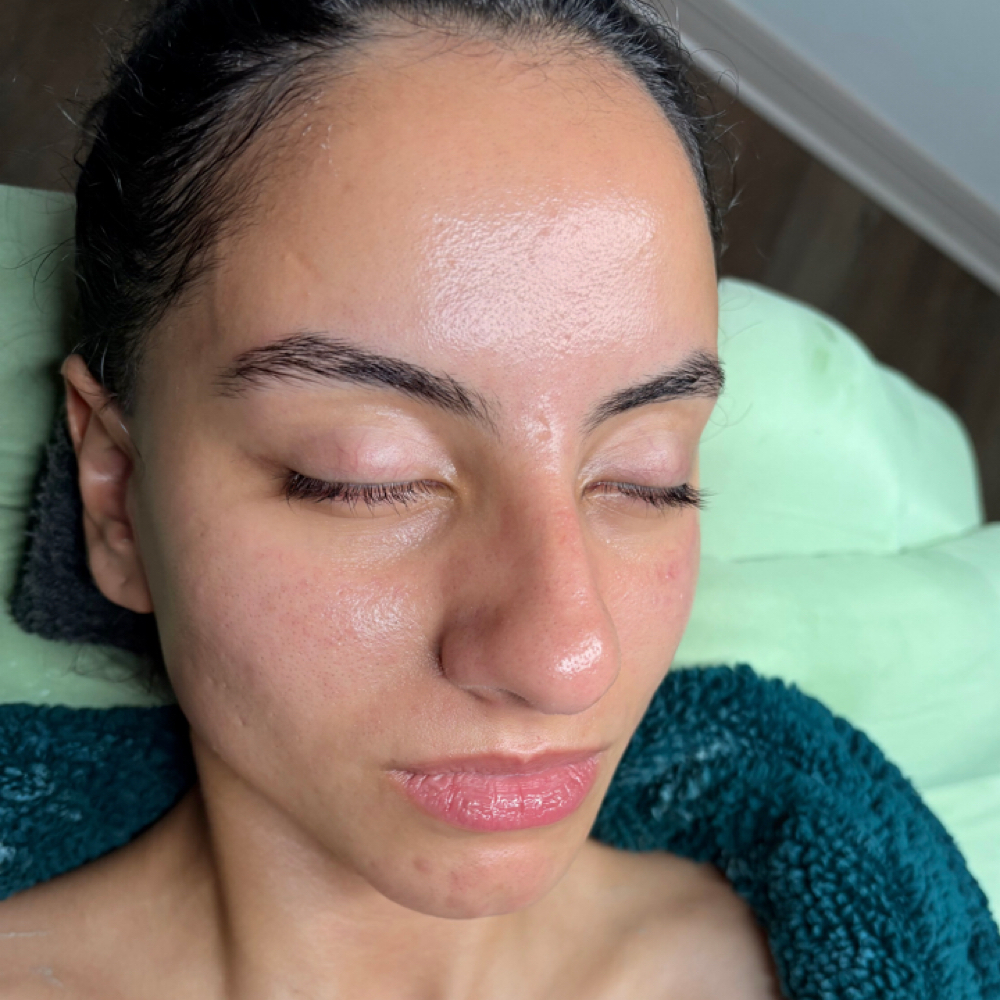 Glo₂ Glass Glow RF Facial at The Holistic Glow in Gainesville, FL