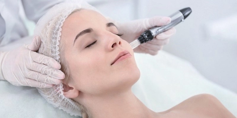 Microneedling Treatment