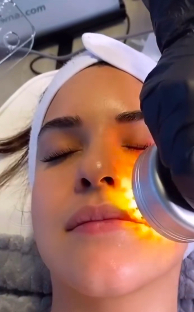 Microcurrent Facial