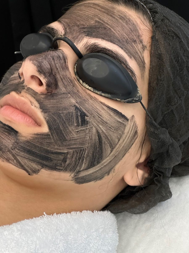 Hollywood Peel