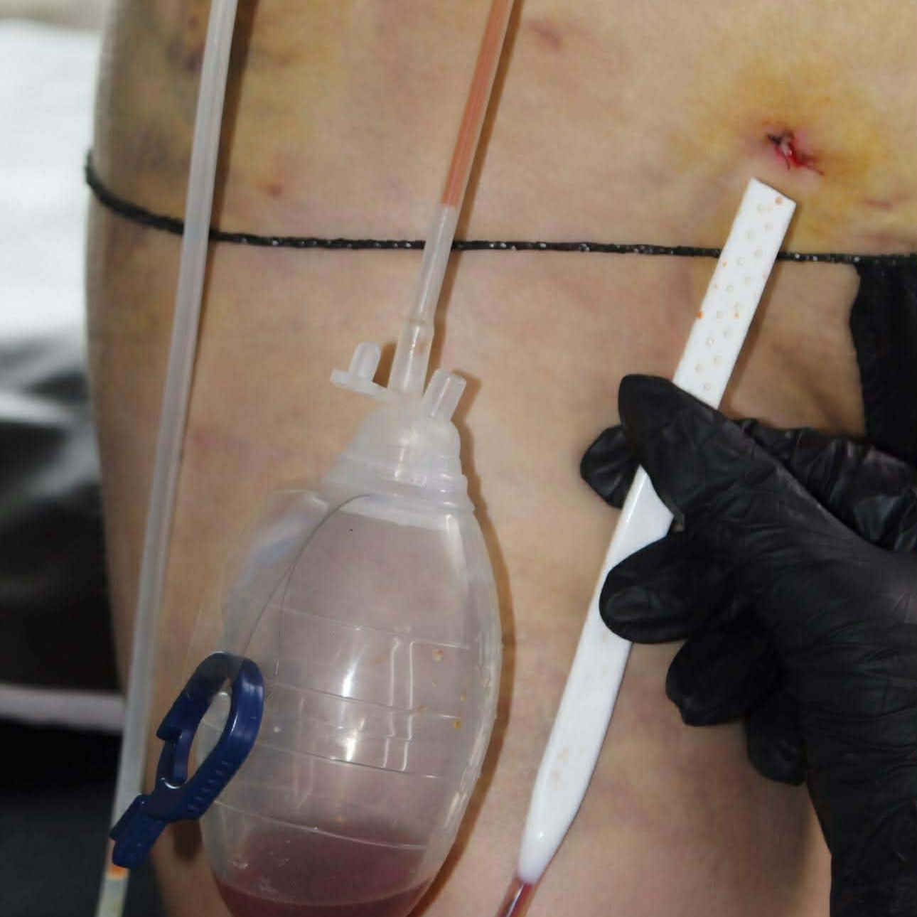 Nurse Post Op at Elevé Body Aesthetics in Milliken, CO