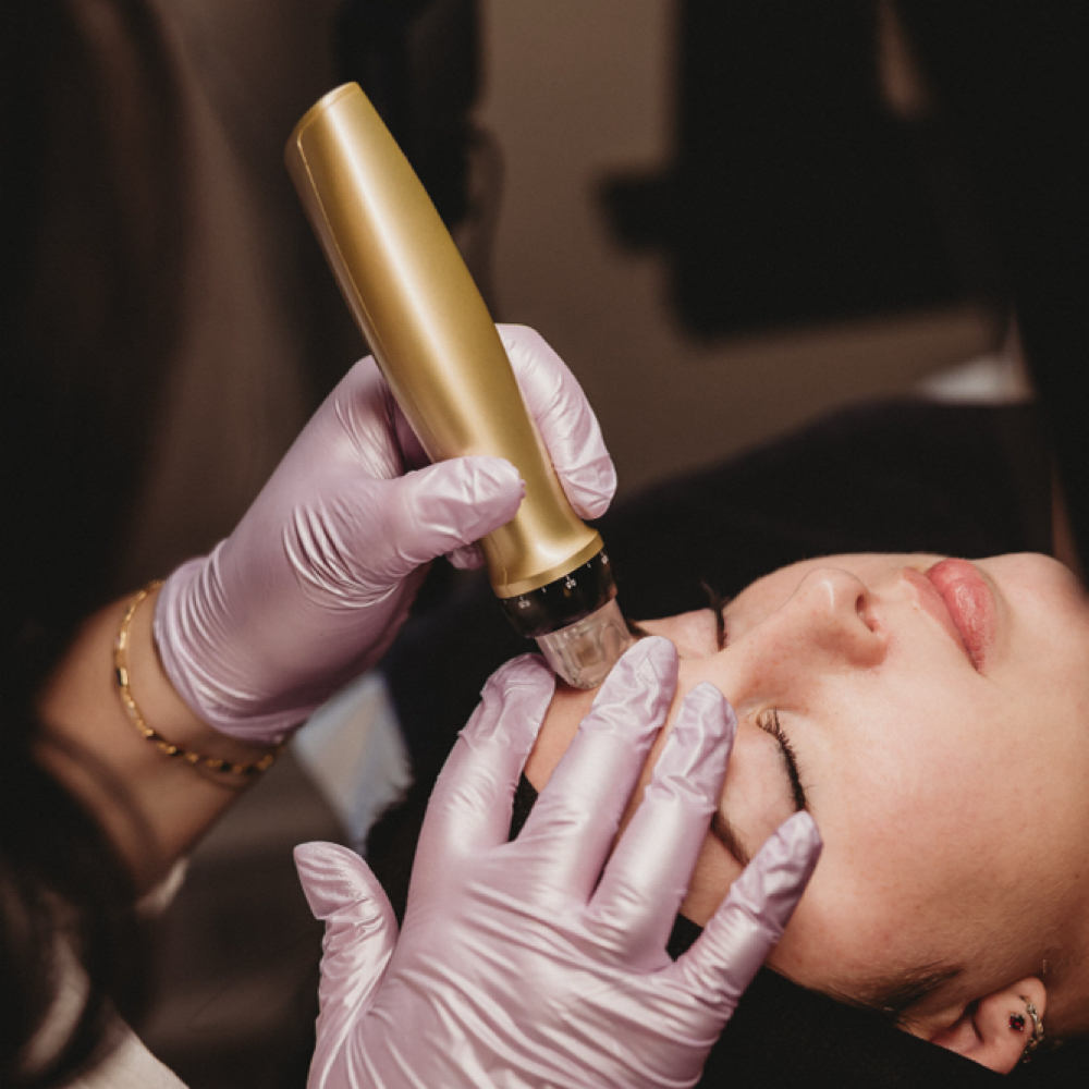 Microneedling/ Nano Infusion at Aurora Beauty in Normal, IL