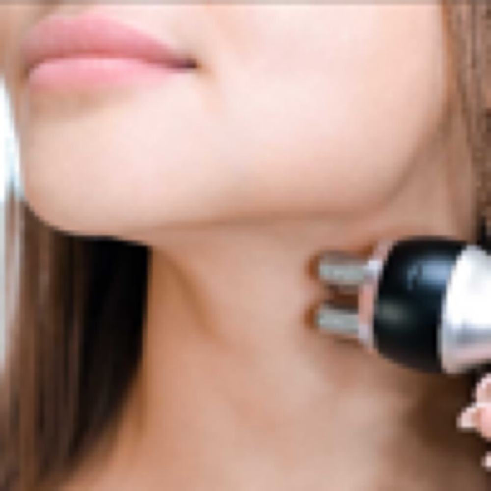 Package Chin RF (6) at Healthy Skin Day Spa in Abilene, TX