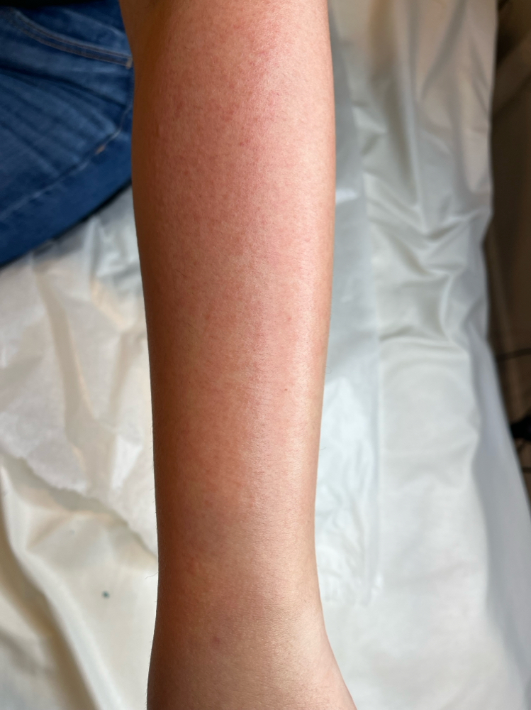 Arm Wax