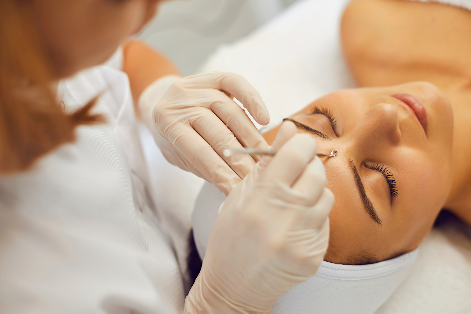 Acne Facial Treatment