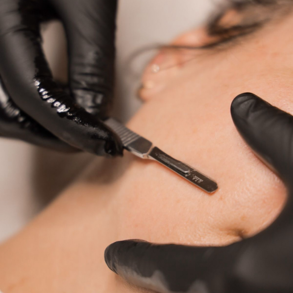 Dermaplaning (Add On) at Sol Spa & Boutique in Archdale, NC