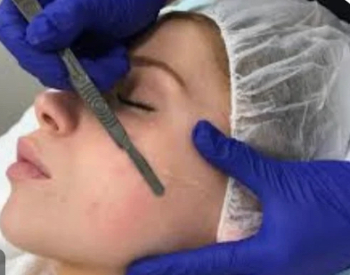 Dermaplaning facial