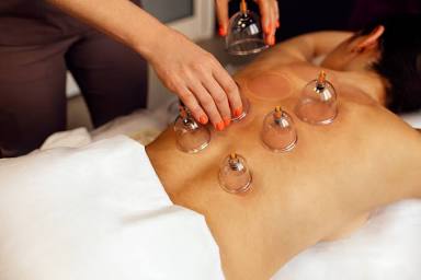 Cupping Therapy