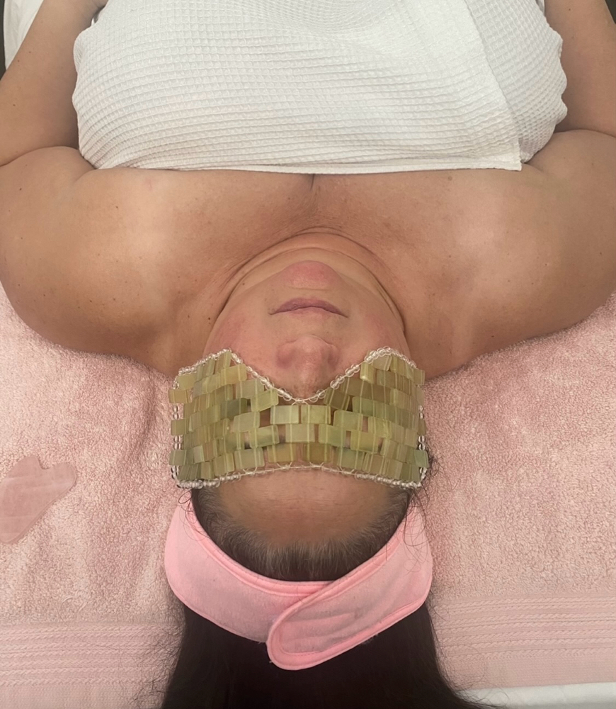 Holistic Medical Chemical Peel