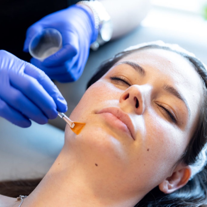 Medical Grade Chemical Peels at Dashmir Beauty Lounge in Roswell, GA